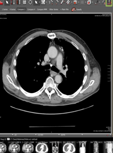 A CT study open in your existing PACS viewer